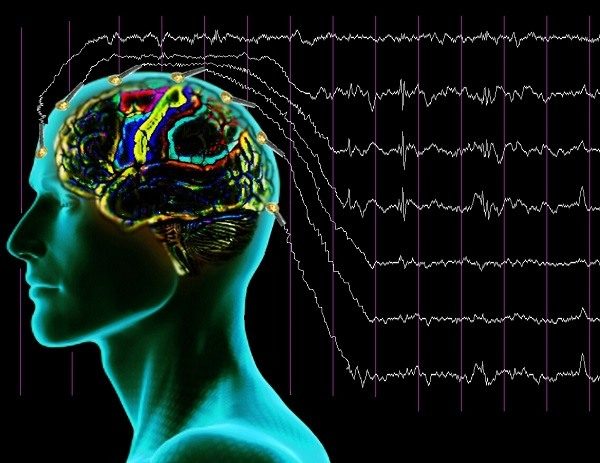 Electroencefalografie